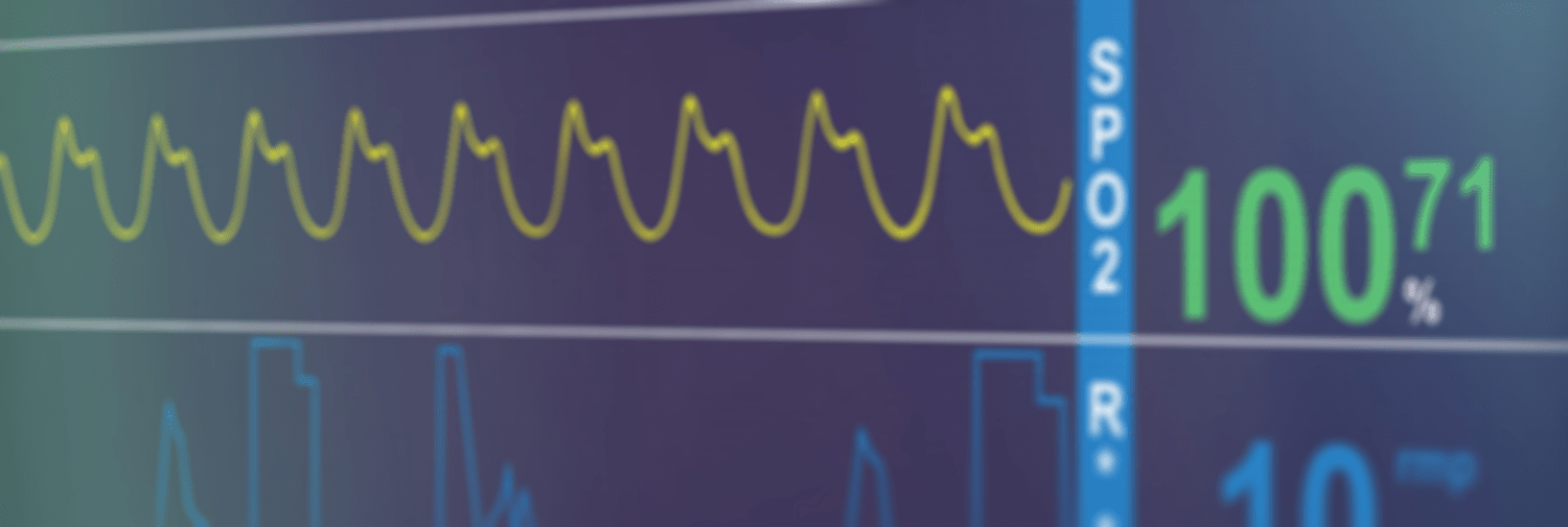 ekg machine