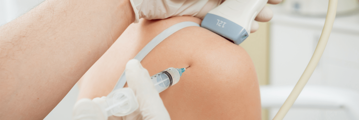 ultrasound guided joint injection in shoulder