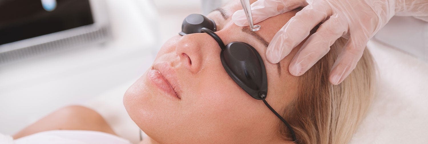 woman receiving laser hair removal for face