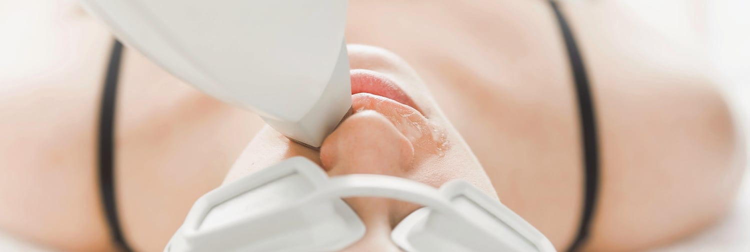 woman undergoing laser hair removal treatment on upper lip