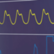 ekg machine