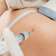 ultrasound guided joint injection in shoulder
