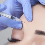doctor administering botox injections