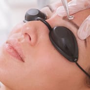 woman receiving laser hair removal for face
