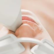 woman undergoing laser hair removal treatment on upper lip