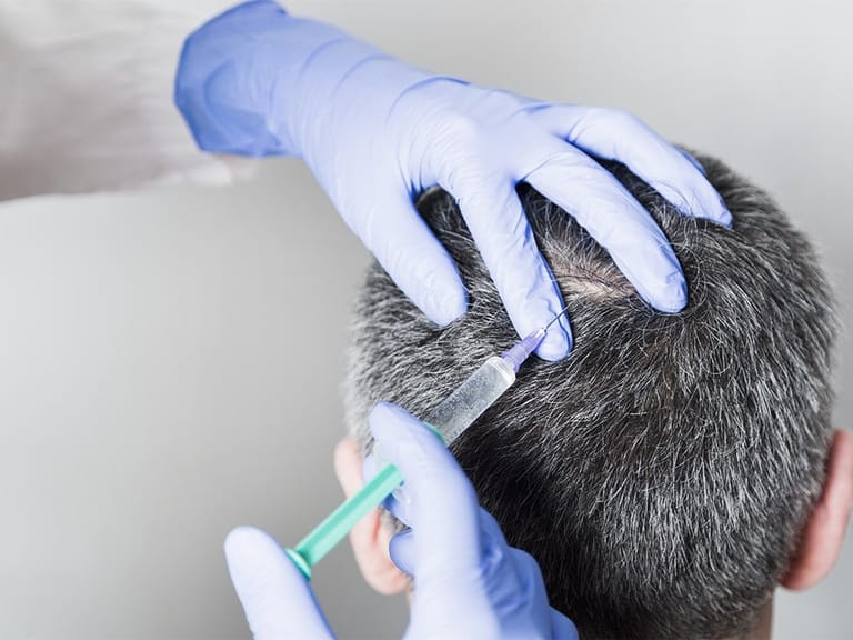 doctor performs prp for hair growth on a man's scalp