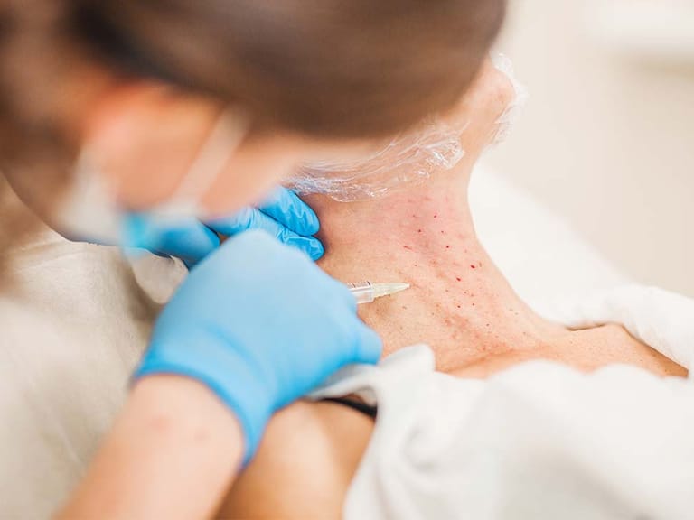 woman receiving neck botox injections
