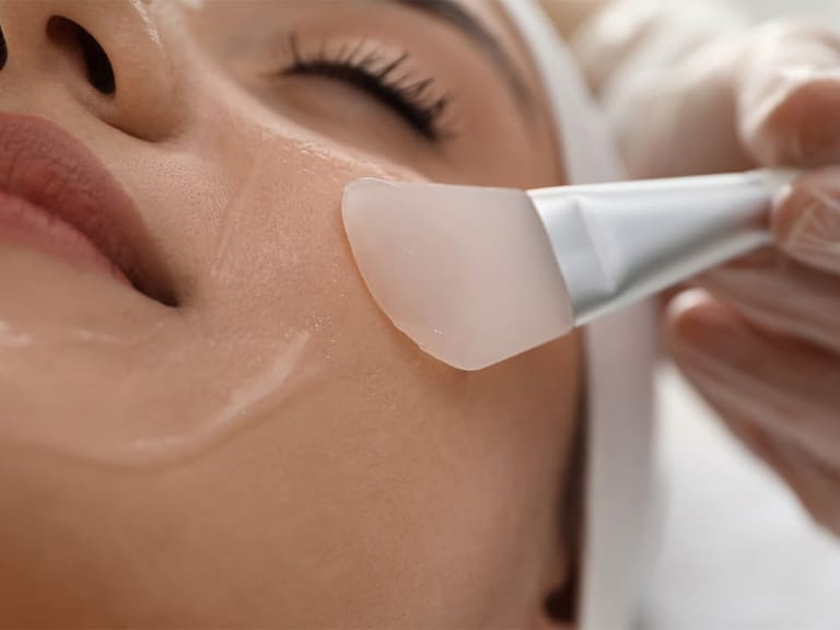 a woman receiving a chemical peel