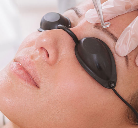 woman receiving laser hair removal for face