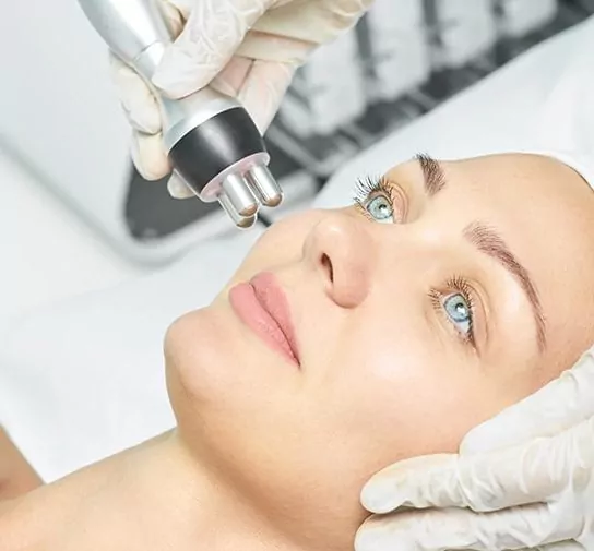 rf skin tightening procedure on woman's face
