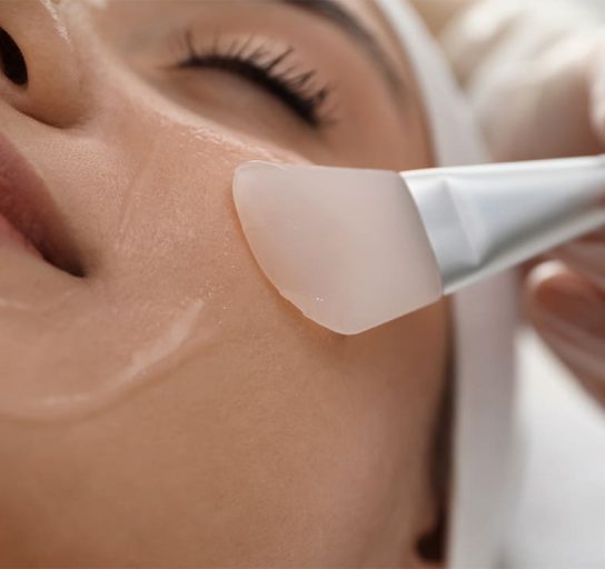 a woman receiving a chemical peel