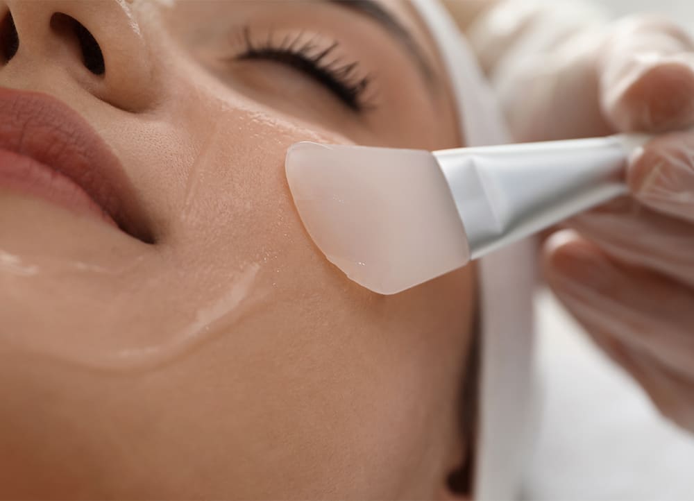 a woman receiving a chemical peel